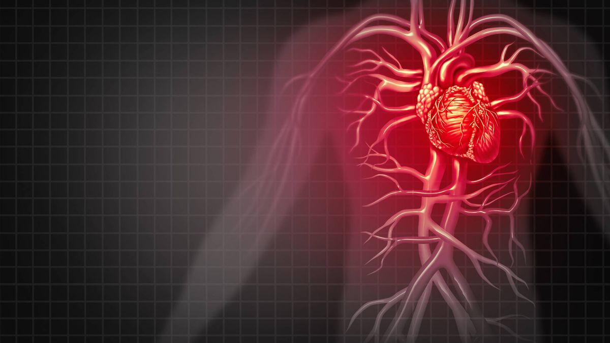 Las causas ocultas que pueden provocar que te dé un infarto