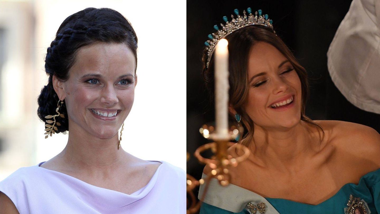 El antes (2013) y el después (2020) en la sonrisa de Sofia Hellqvist. (Getty)