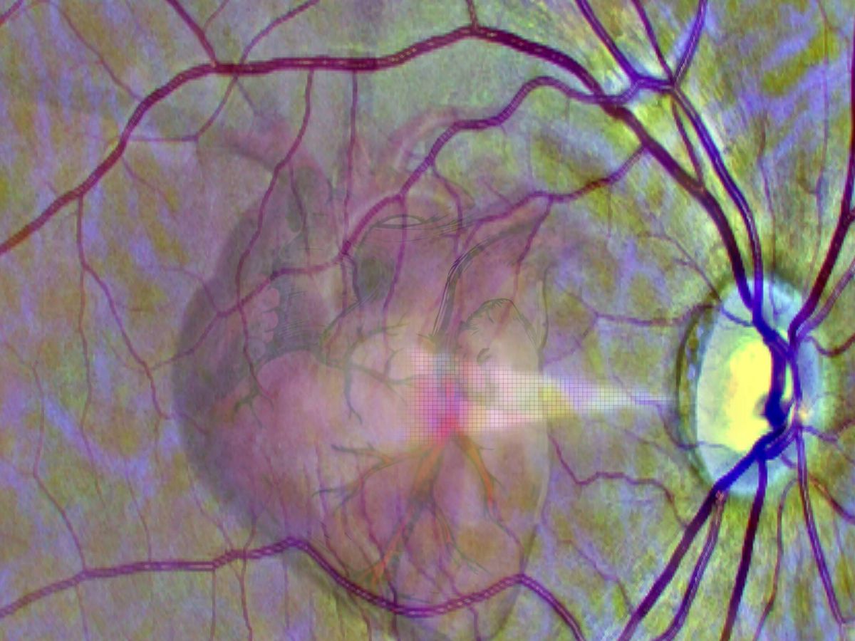 Foto: Representación del escáner del ojo para detectar problemas de corazón. (Universidad de Leeds)