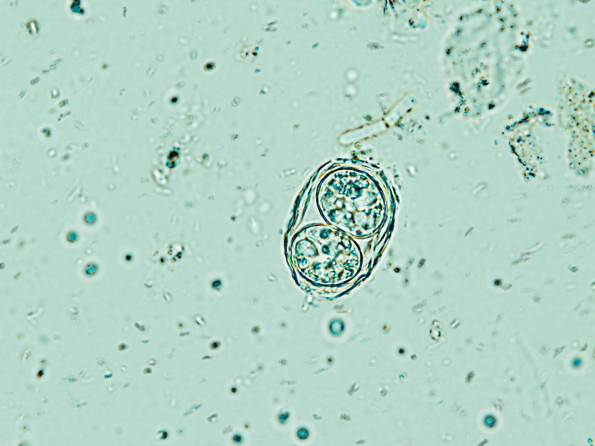 Foto: 'Toxoplasma gondii' bajo el microscopio. (Fuente: iStock)