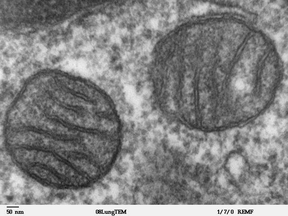 Foto: Dos mitocondrias. Foto Wikipedia