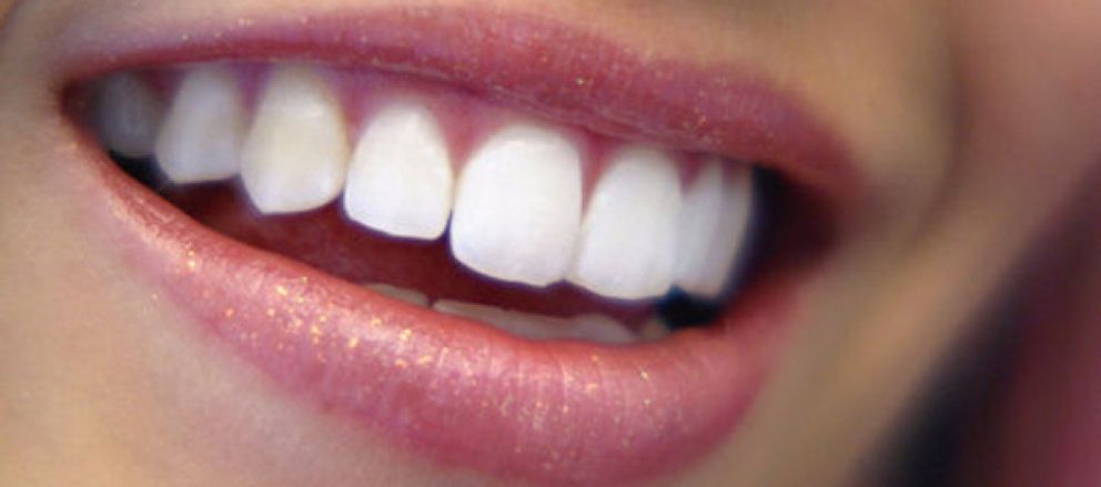 Foto: La dentadura es el problema estético que más preocupa a los españoles