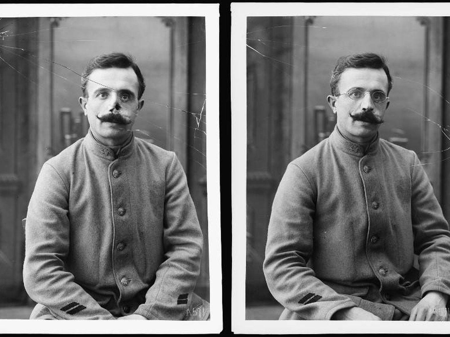 Un soldado sin la máscara y con su posterior colocación (Library of Congress)