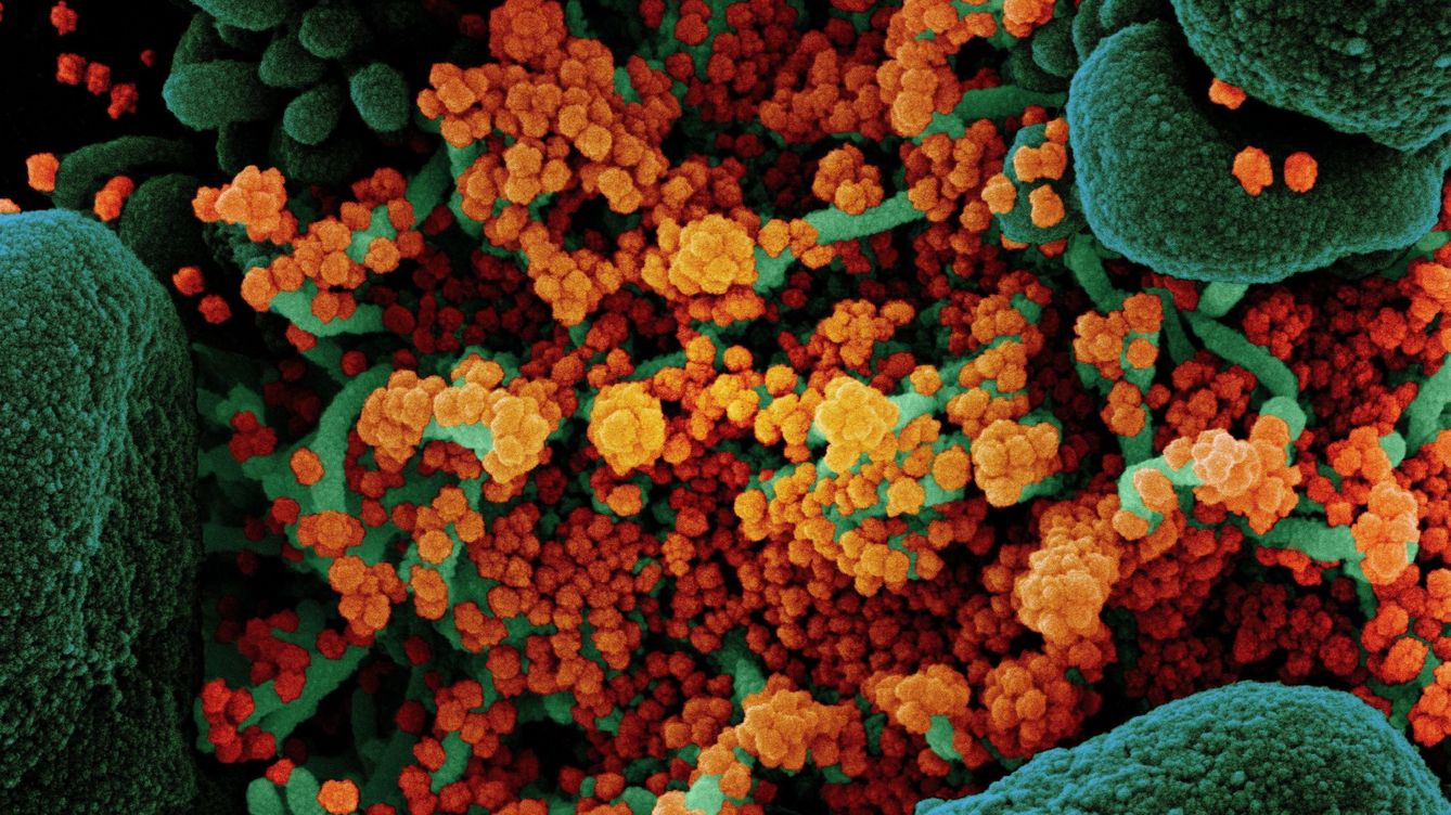 Foto: Imagen del virus SARS-CoV-2 . (EFE)