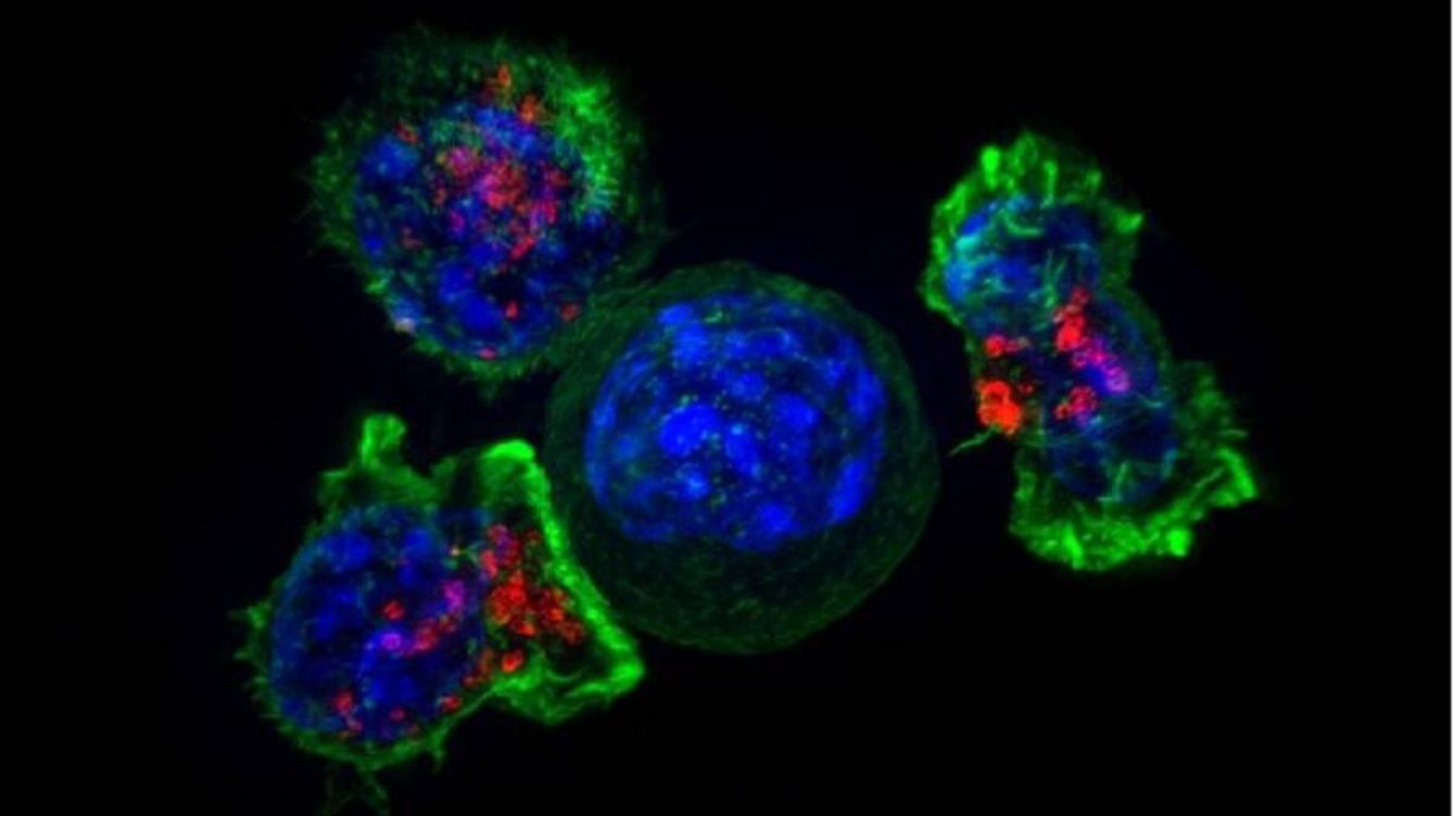 Foto: Células CAR-T (rojo y verde) rodeando células cancerosas (azul). (NIH).