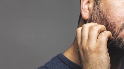 Noticia de ¿Tienes picazón en la barba por dermatitis o psoriasis? Así puedes solucionarlo