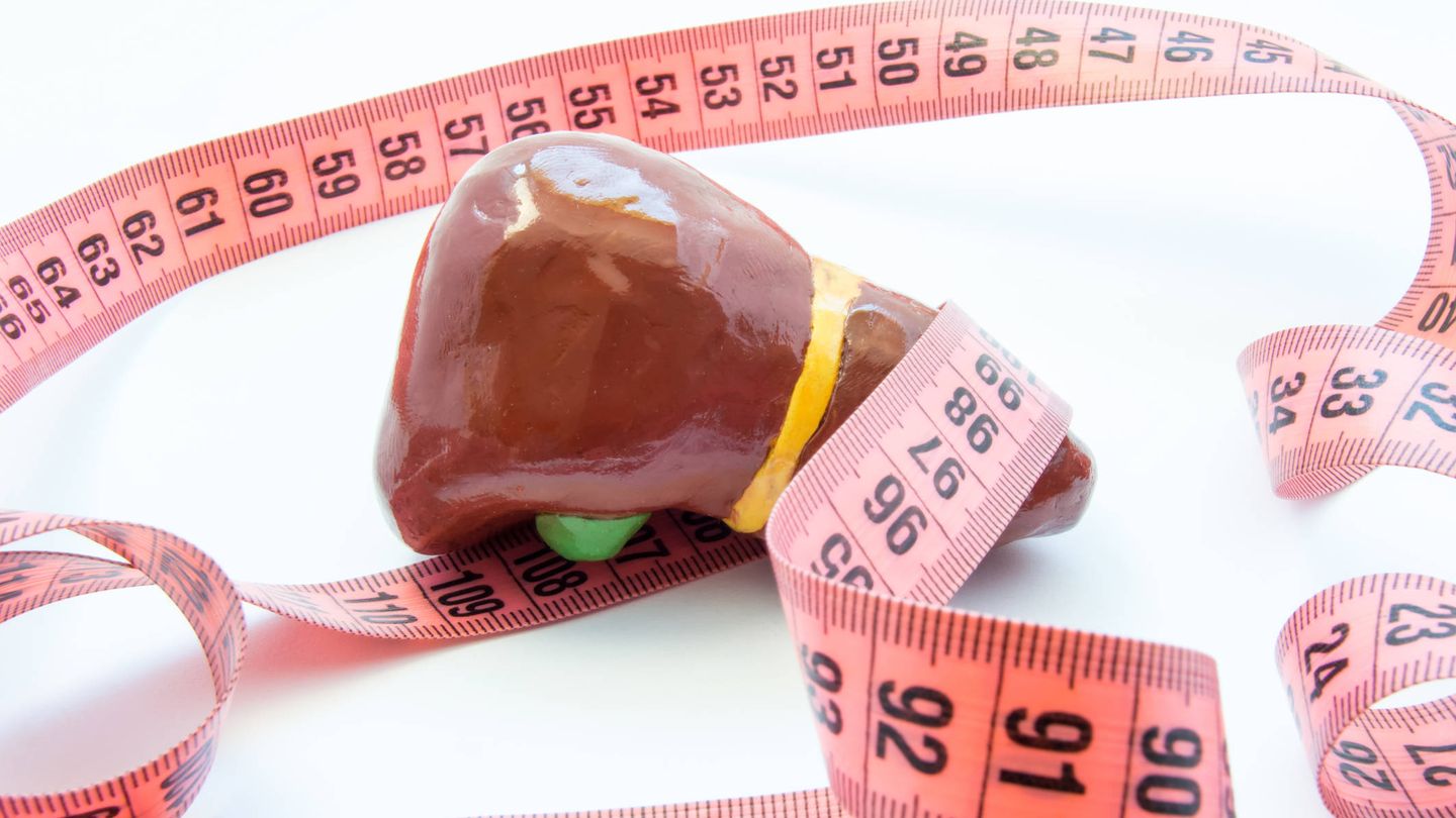 El hígado graso está asociado fundamentalmente a la obesidad. (iStock)