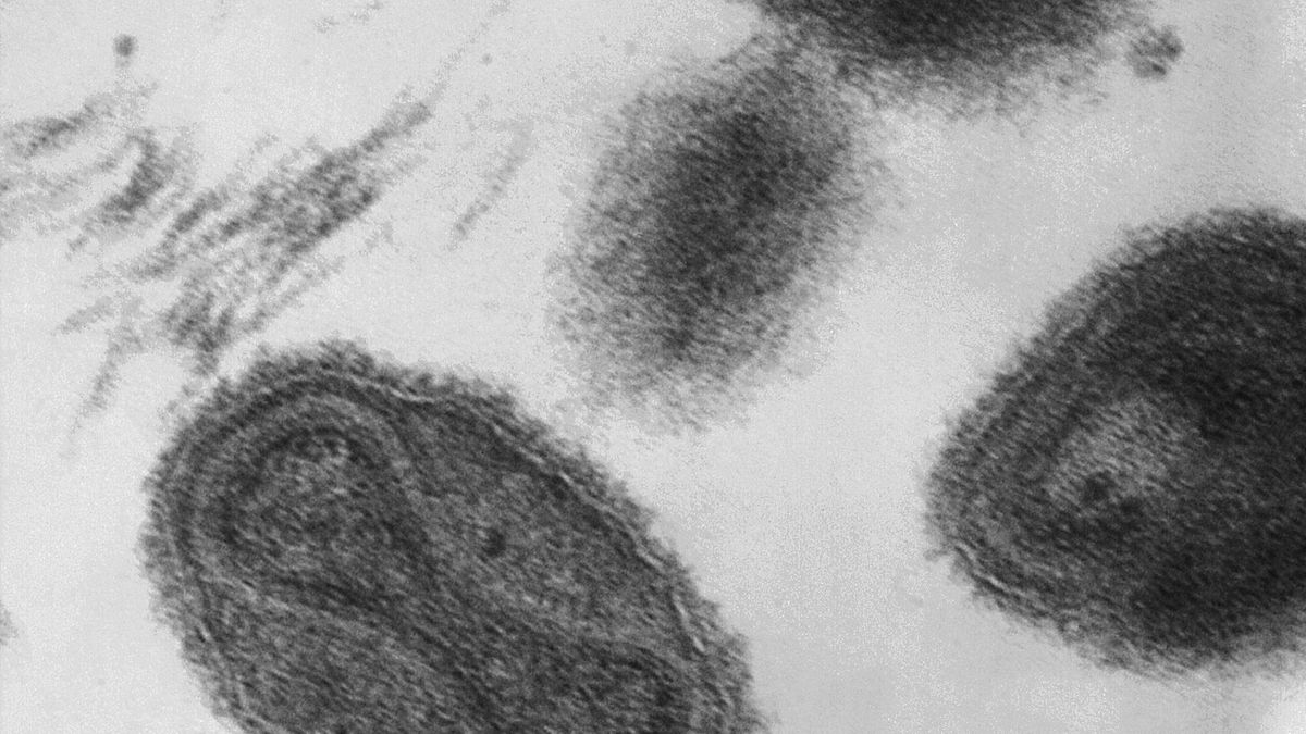 Explota un laboratorio ruso en el que había muestras del virus mortal de la viruela
