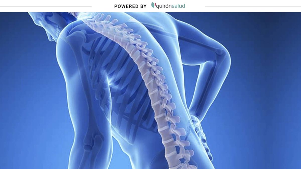 No solo afecta a mujeres ni el calcio se deja de absorber: mitos de la osteoporosis  