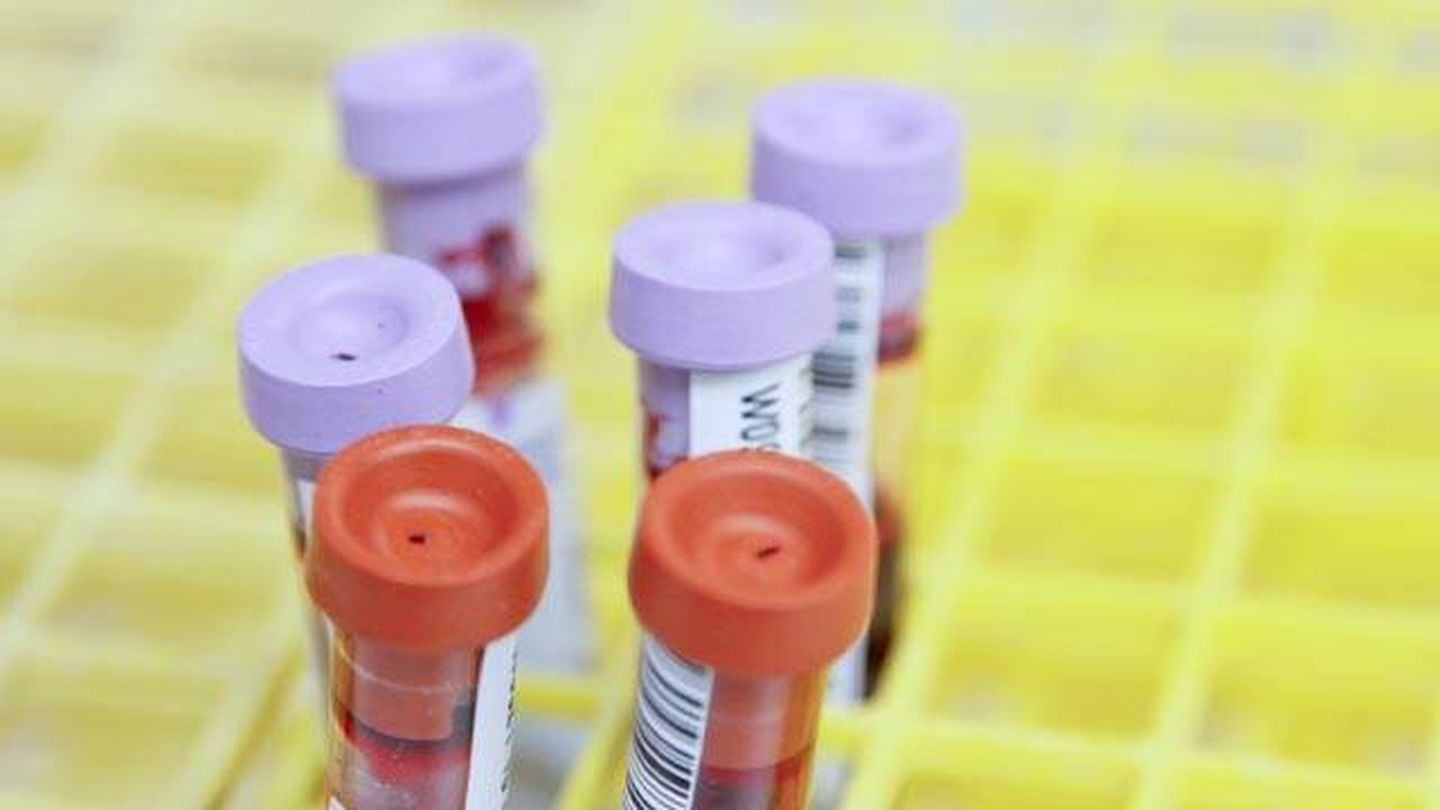 Las muestras de sangre son fundamentales para la detección precoz del cáncer. (National Cancer Institute)