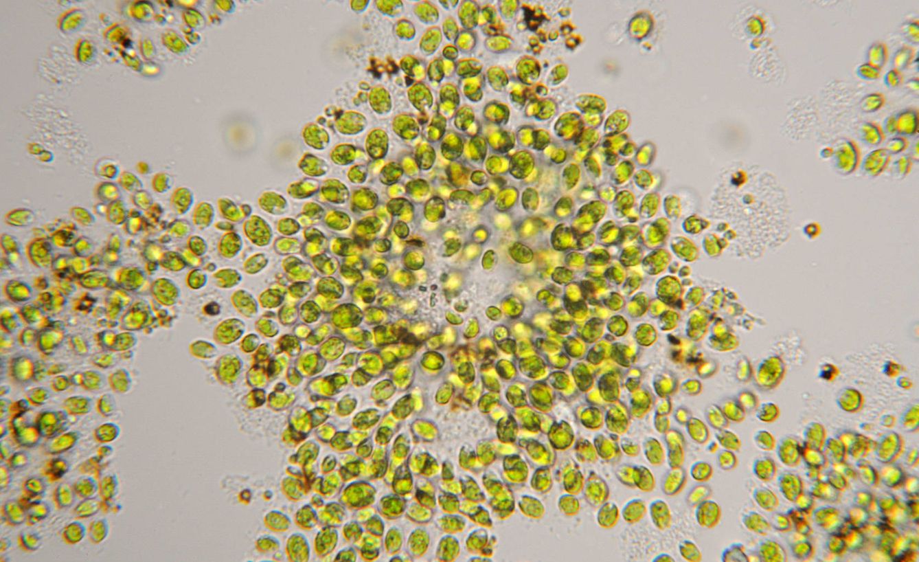 El alga, en el microscopio. (iStock)