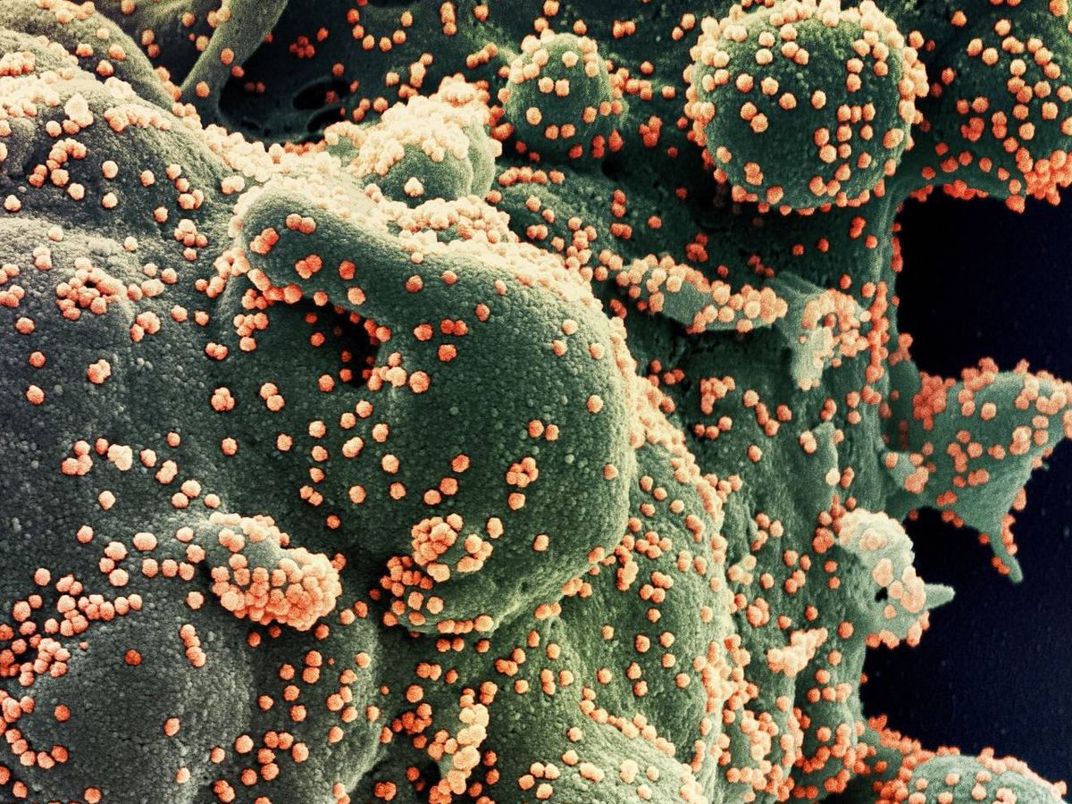 Foto: Coronavirus SARS-CoV-2 (en naranja) invadiendo una célula (en verde). (Foto: NIAID-NIH)