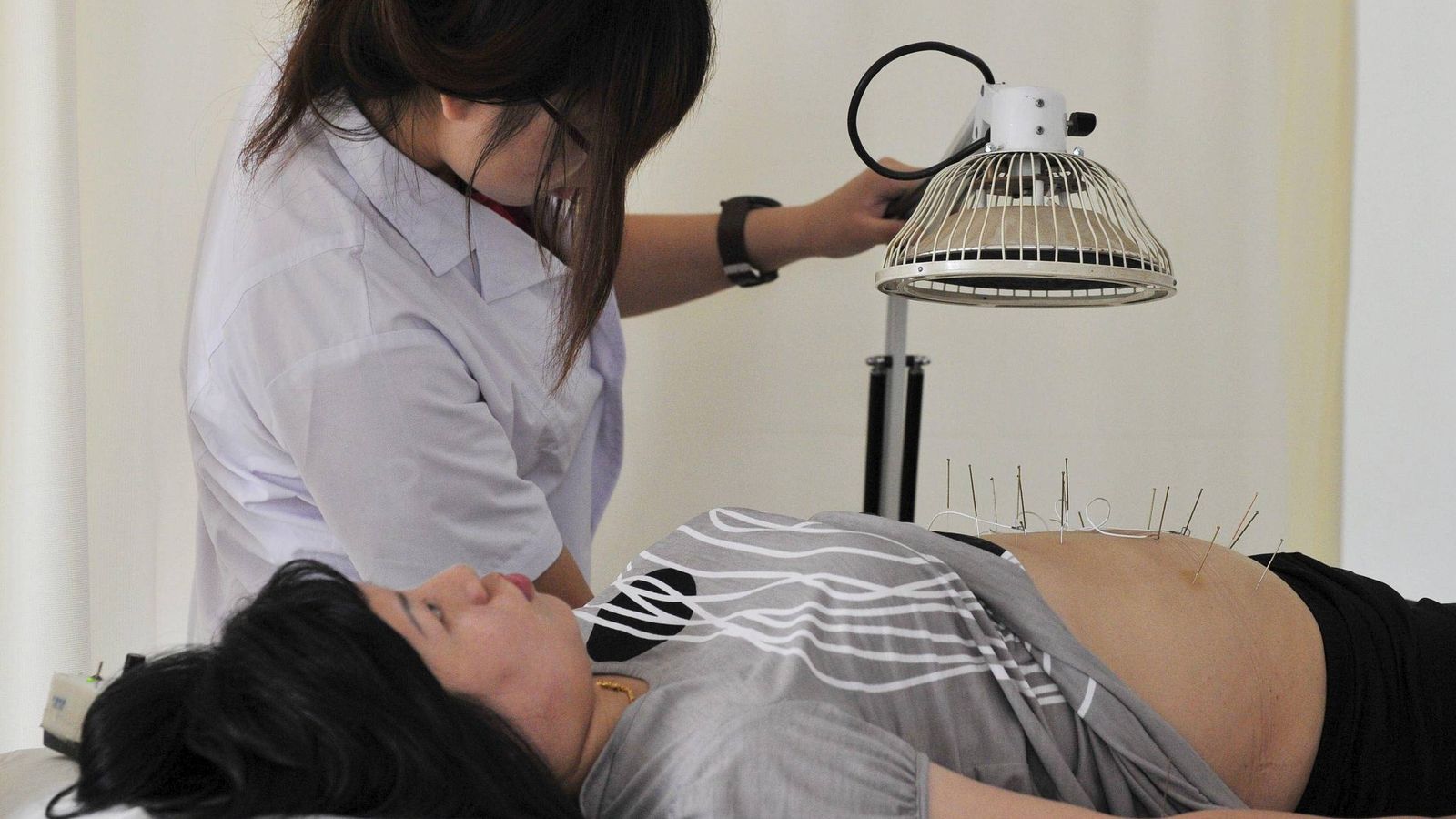 Foto: Una mujer recibe un tratamiento con acupuntura. (EFE)