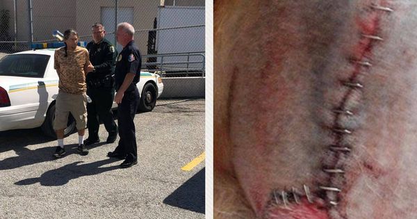 Foto: A la izquierda, Suthann, en el momento de ser detenido; a la derecha, la cicatriz tras la operación a TT (Foto: Sheriff County Brevard)