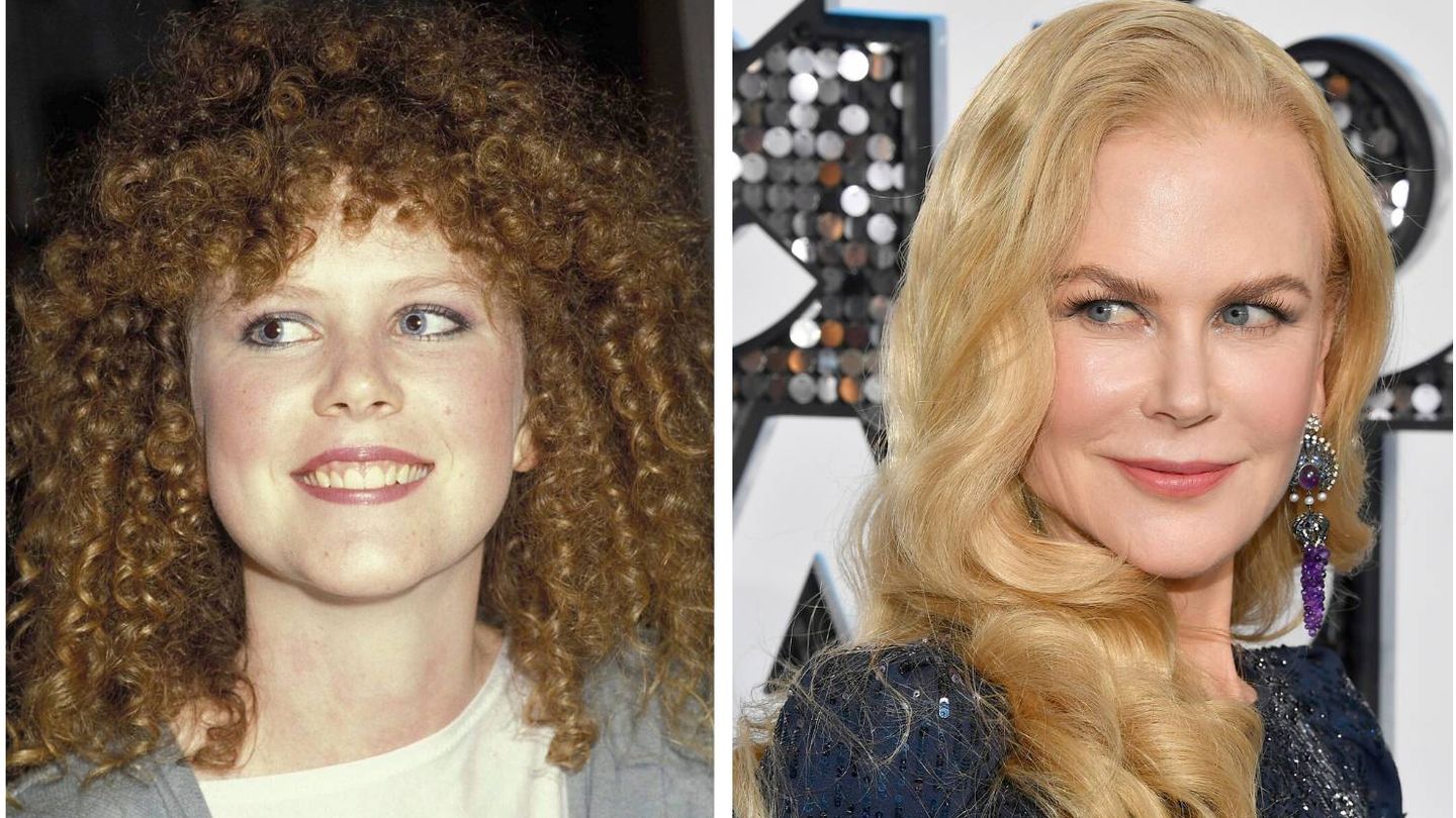 Nicole Kidman, en 1983 y en 2020. (Getty)