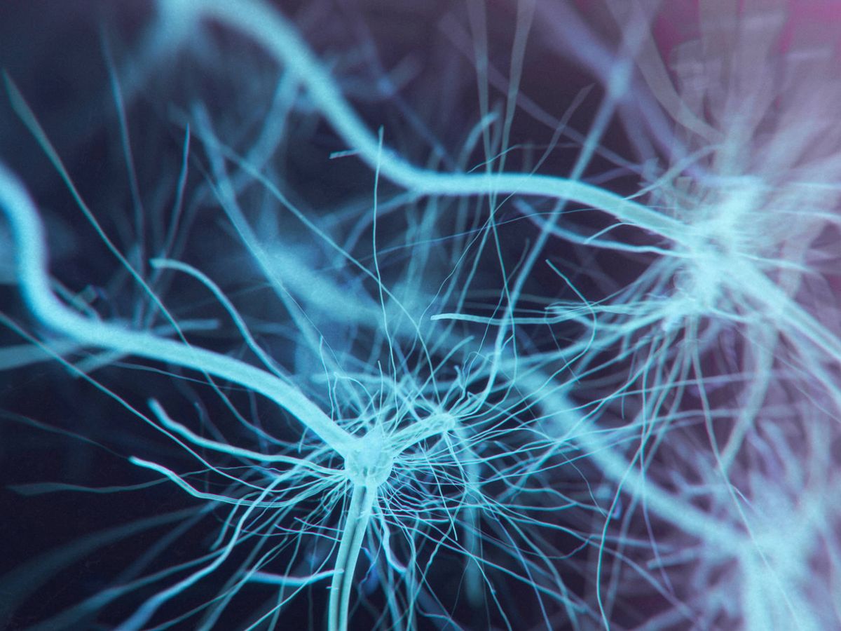 Foto: Reconstrucción de neuronas motoras, las células nerviosas a las que ataca la ELA. (iStock)