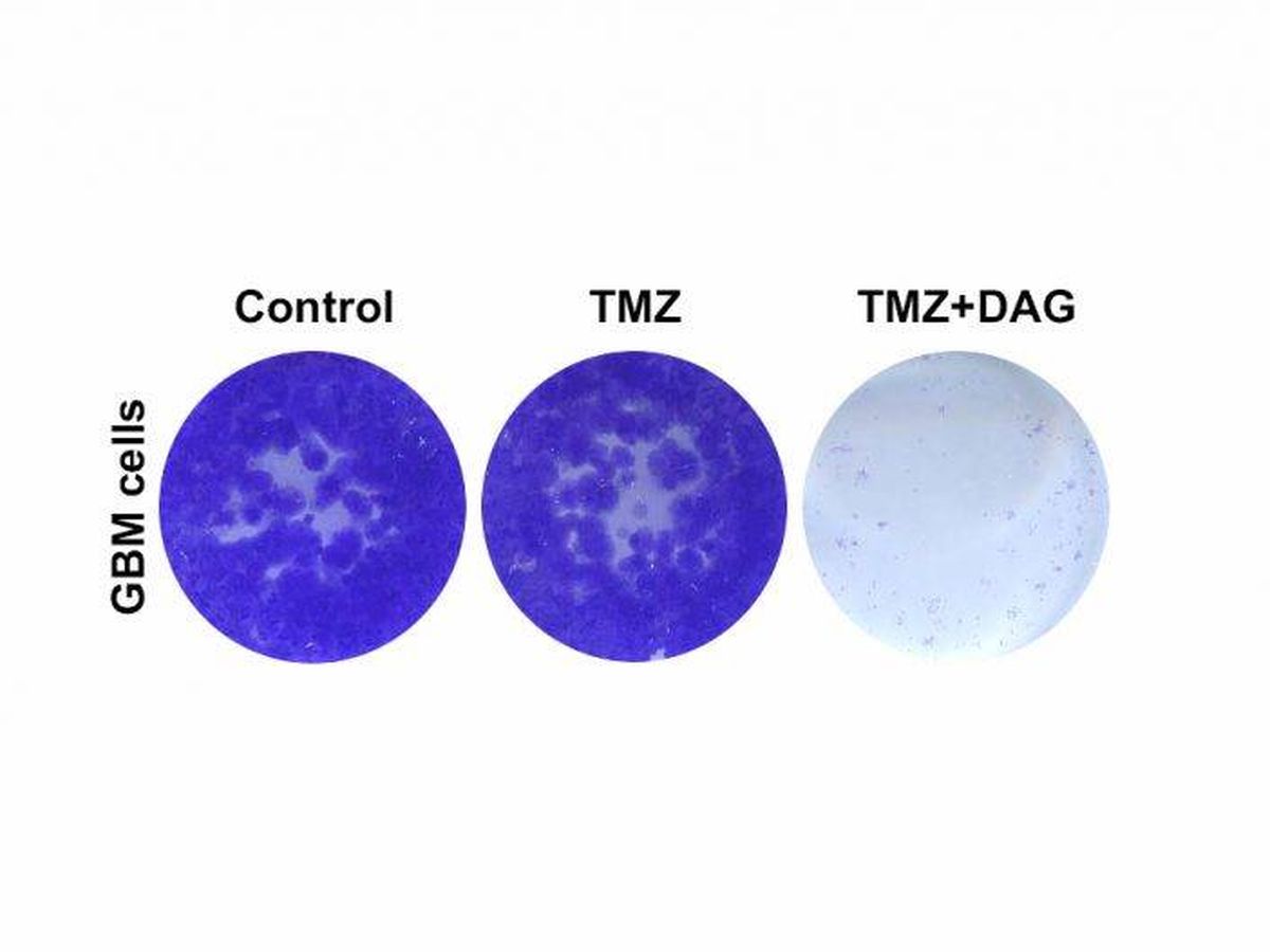 Foto: La combinación de temozolomida (TMZ) con dianhydrogalactitol (DAG; placa de cultivo derecha) es capaz de eliminar células de glioblastoma resistentes a la terapia convencional con temozolomida (TMZ; centro). (CNIO)