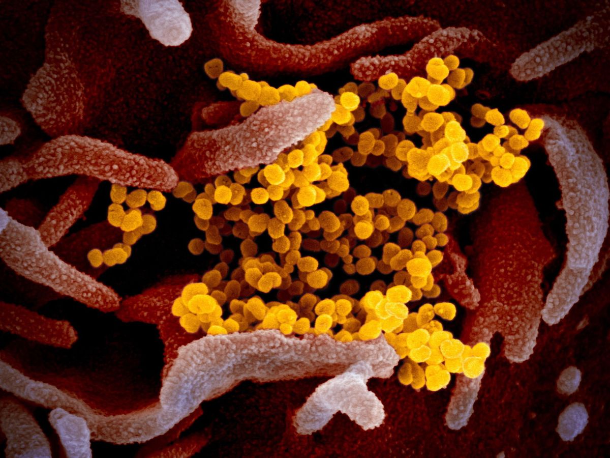 Foto: Investigación sobre el nuevo coronavirus (EFE)
