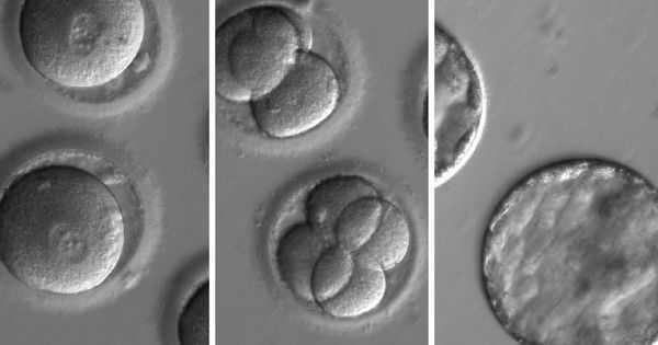 Foto: La herramienta CRISPR podría haberse usado para manipular el genoma de estos supuestos bebés (EFE)