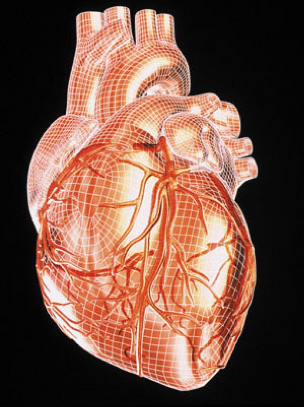 Foto: Logran implantar válvulas cardiacas sin cirugía a corazón abierto