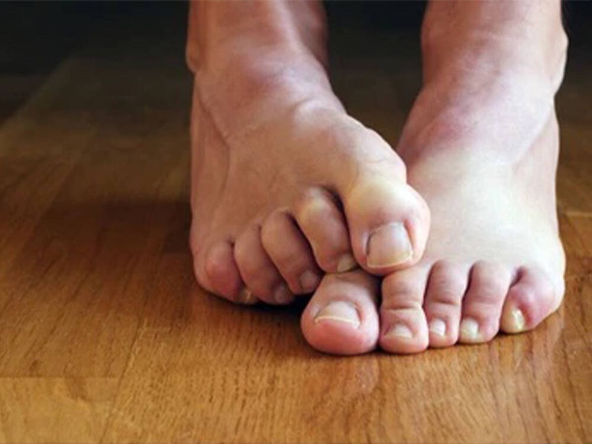 Foto: ¿Te huelen los pies? Con este truco absorberás el sudor y evitarás malos olores (iStock)
