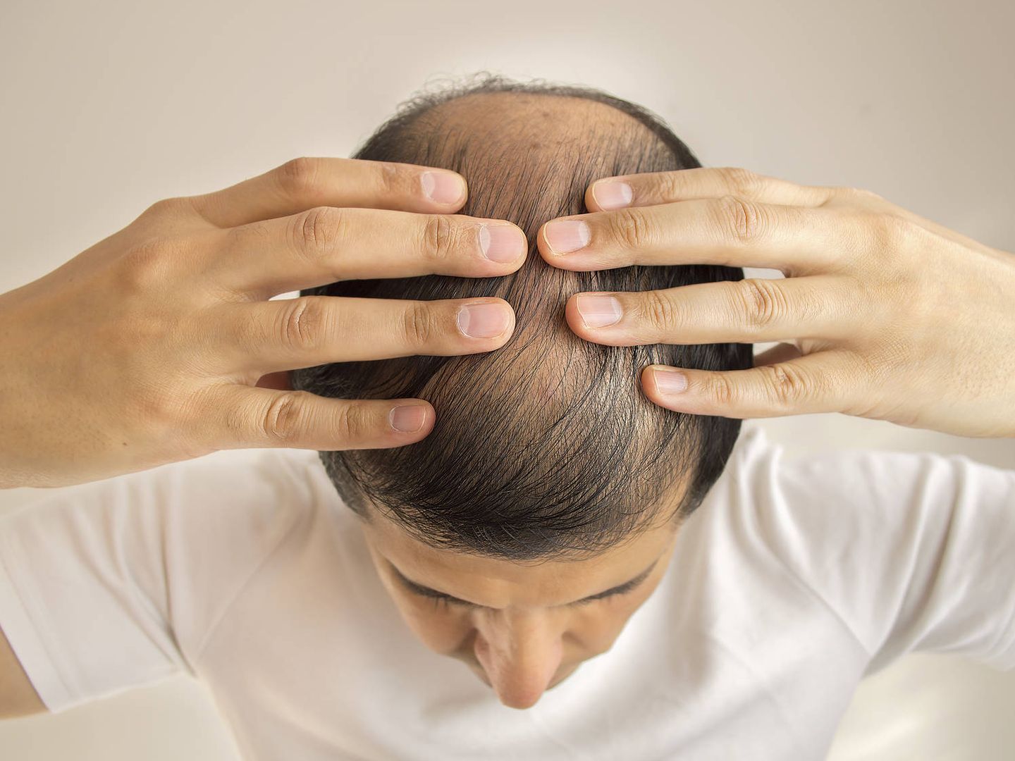 close up of man controls hair loss