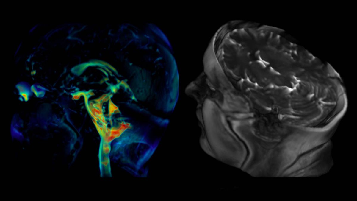 El latido del cerebro grabado por primera vez en 3D