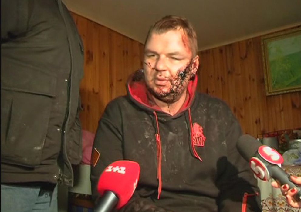 Foto: Dmytro Bulatov tras ser encontrado en las afueras de Kiev (Reuters).