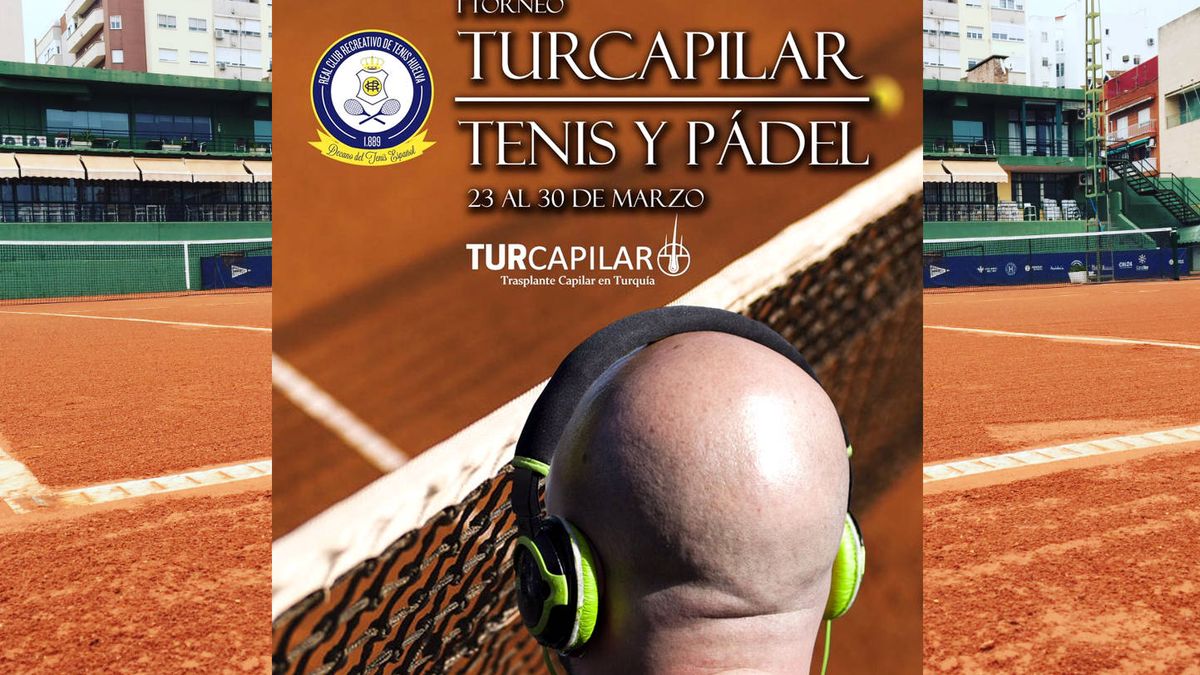 Un torneo de tenis regala como premio un trasplante capilar en Turquía