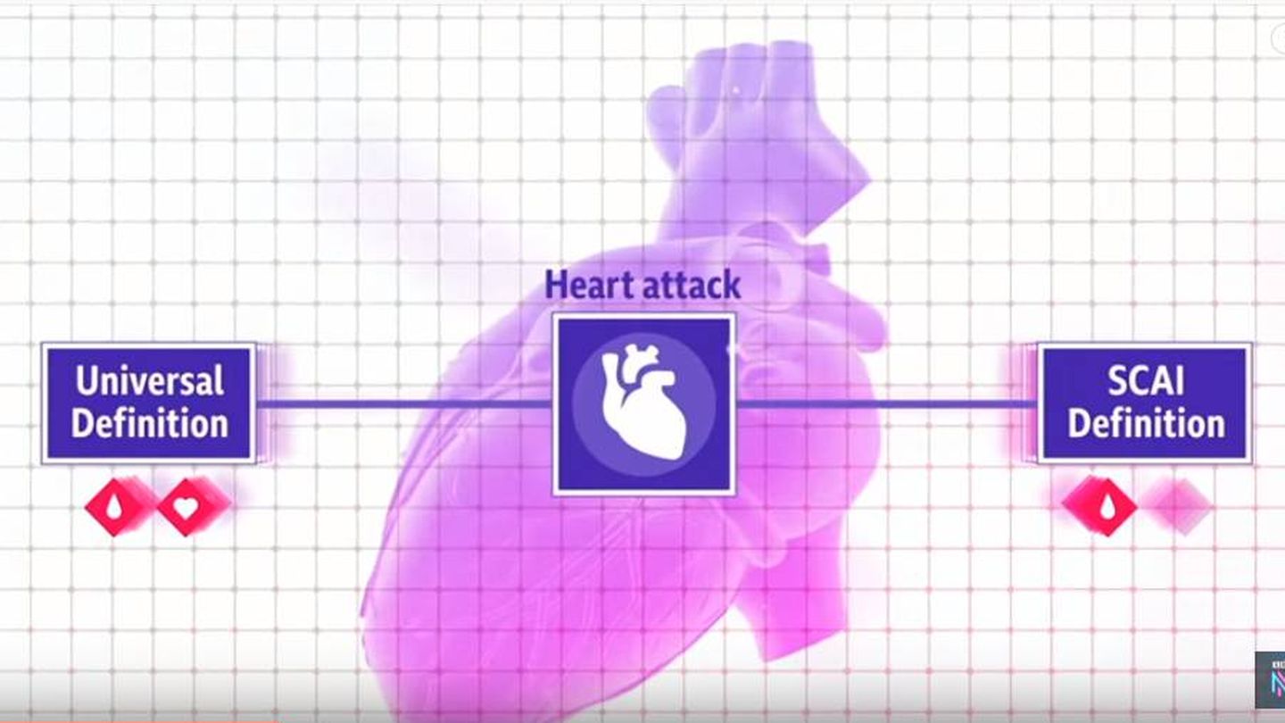 Los investigadores crearon una definición propia de lo que debía ser considerado un infarto. (Newsnight)