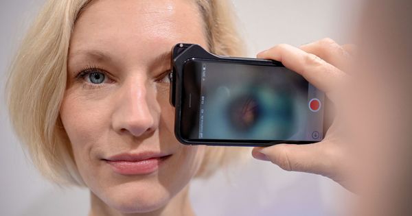 Foto: Una mujer se hace un examen de retina en Dusseldorf (EFE / EPA)