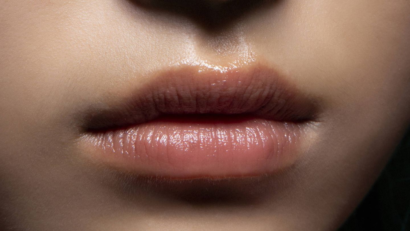 Los rellenos con ácido hialurónico mejoran la hidratación de los labios. (Imaxtree)