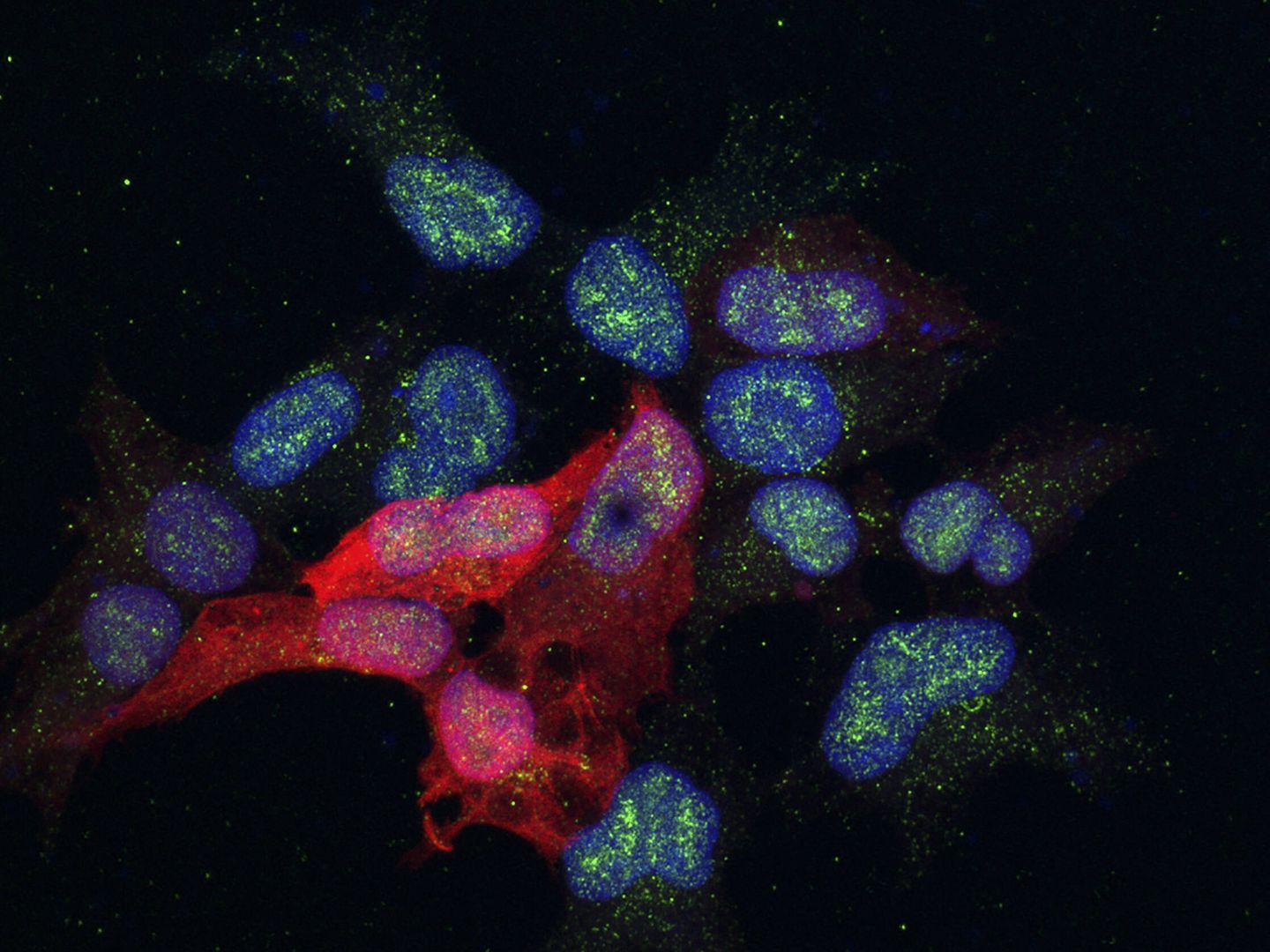 Células en las que se estudia una proteína (en verde) implicada en la metástasis del cáncer de mama. (Alicia Llorente/IRB Barcelona)