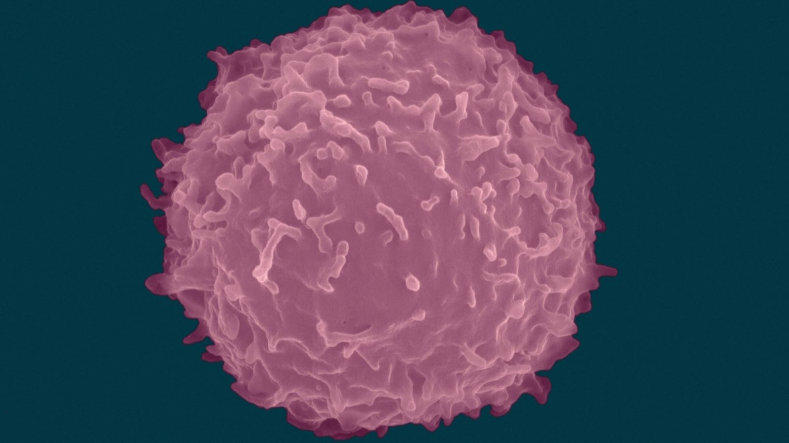 Foto: Una célula T, el linfocito que ataca las infecciones y cuya producción es acelerada por la proteína recién descubierta. (Corbis)