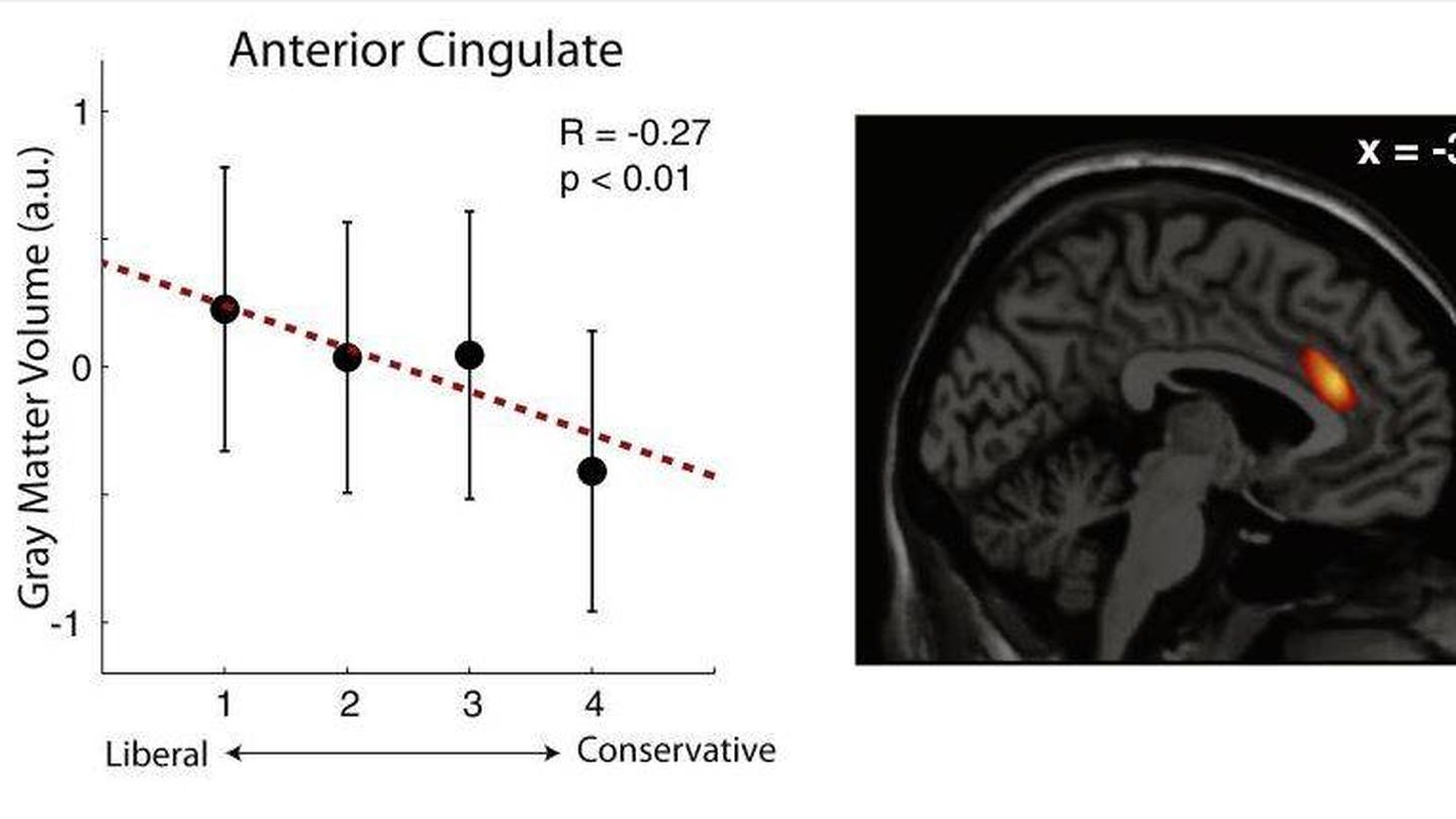Imagen de uno de los estudios que relacionan estructura cerebral y voto. (Current Biology)