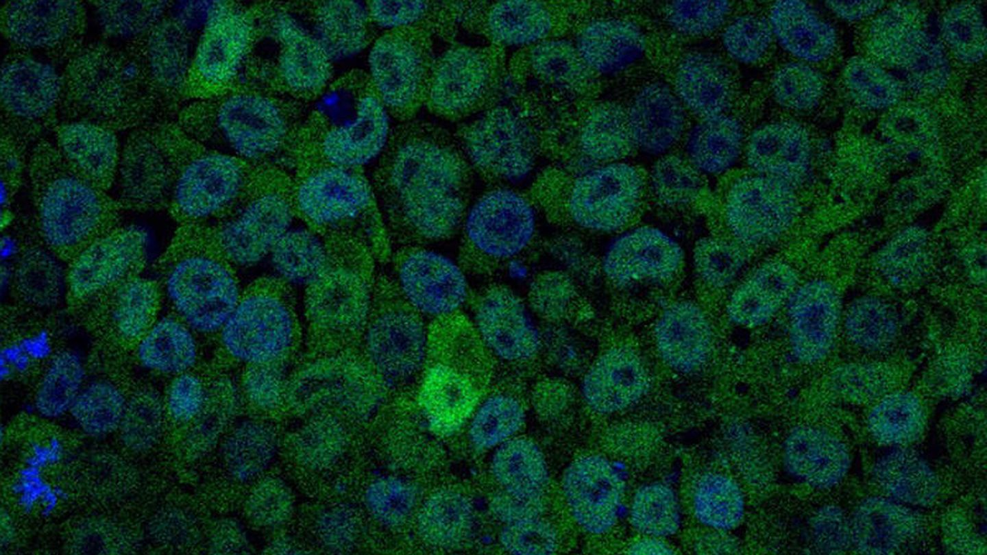 Imagen de células madre embrionarias con bajos niveles de PI3K. (Ana Clara Carrera/CNB-CSIC)
