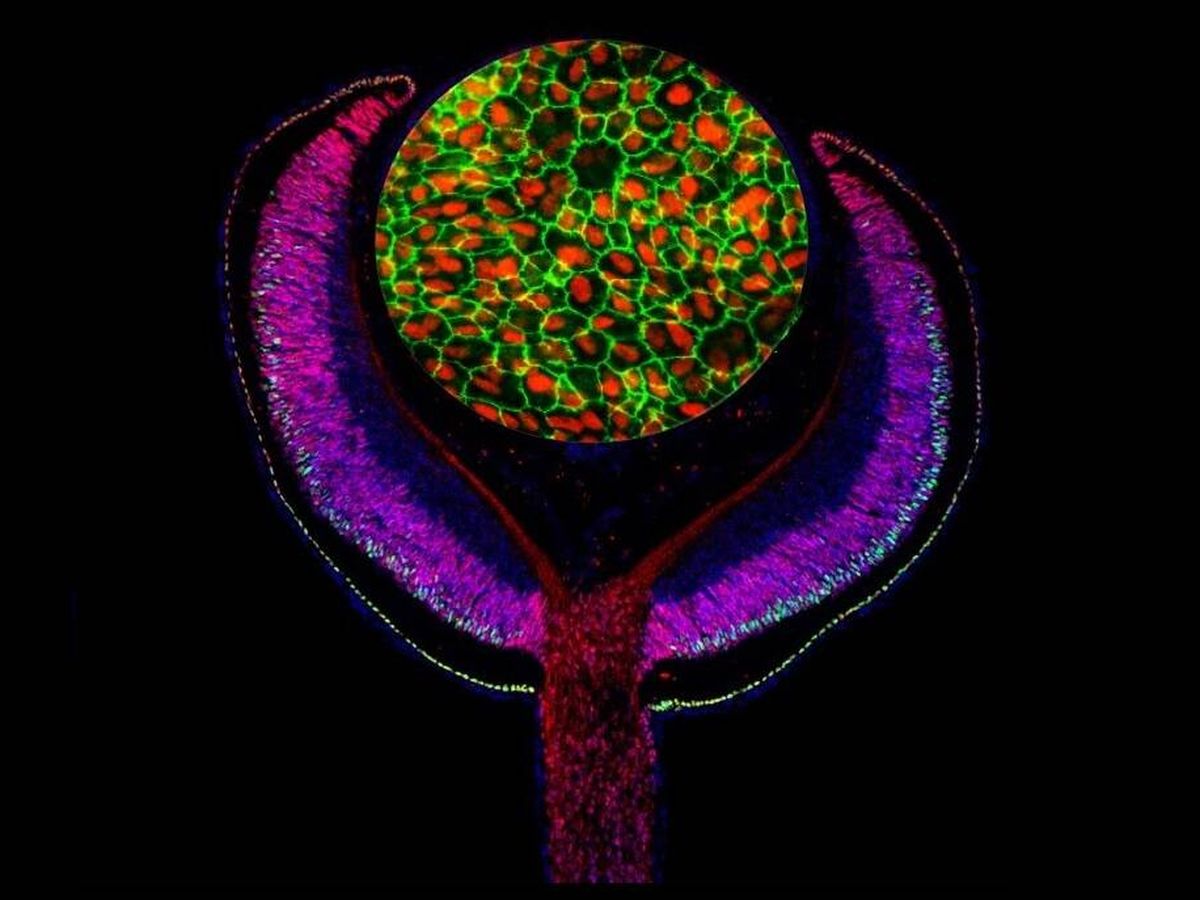 Foto: Anticuerpos contra los factores de transcripción del desarrollo Lhx2 (rojo) y Otx2 (verde), y epitelio pigmentado de retina humana cultivado (RPE) marcado con anticuerpos contra MITF (rojo) y ZO-1 (verde). (Mazal Cohen-Gulkar)
