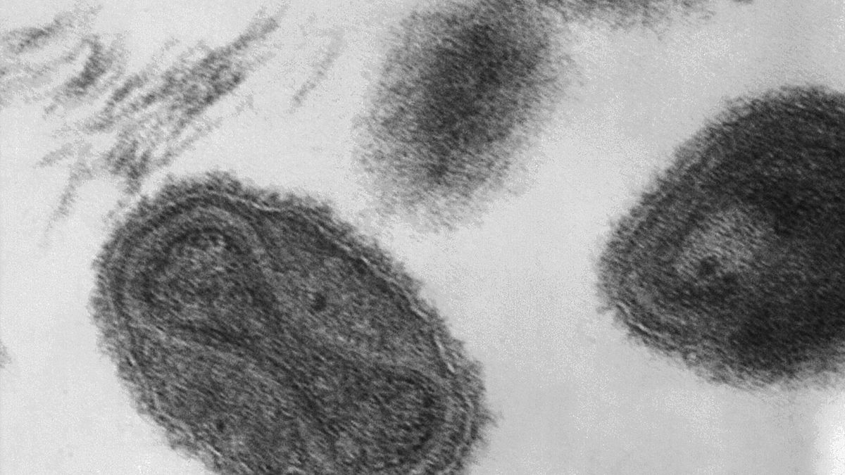 La viruela llegó a los humanos 1.000 años antes de lo que se pensaba
