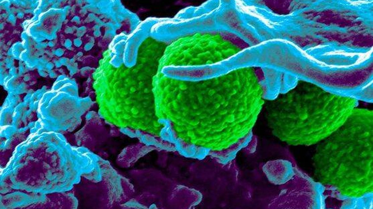 Las superbacterias mataron a 1,2 millones de personas en 2019, más que el sida o la malaria
