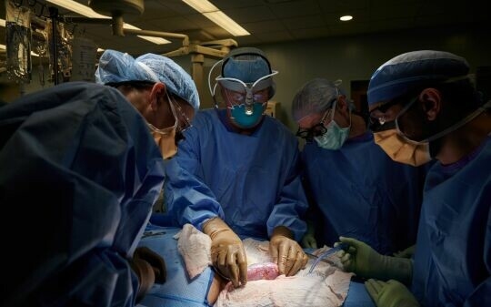 Foto de ¿Qué novedades aporta el primer trasplante renal de cerdo genéticamente modificado?