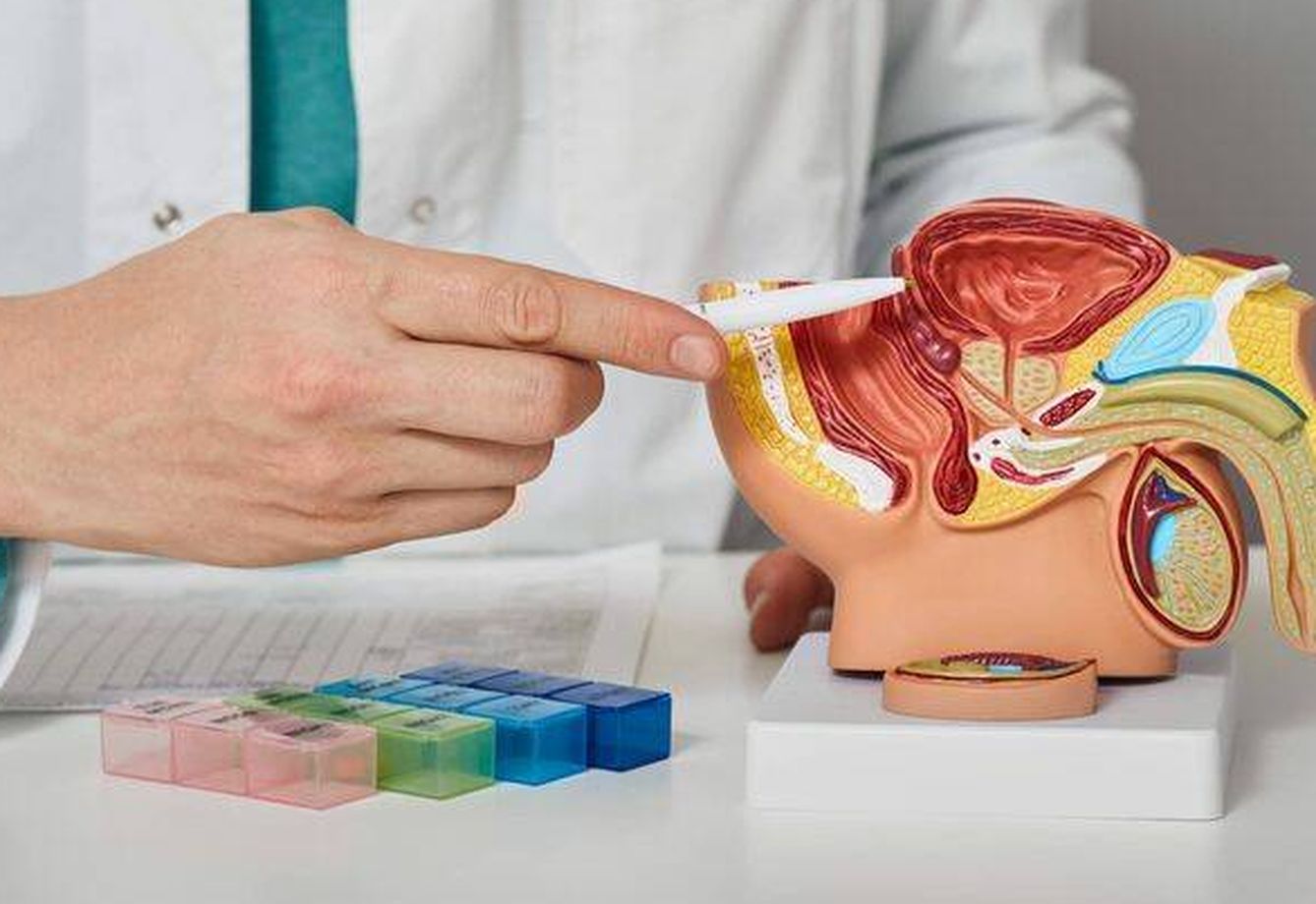 Un doctor explica la anatomía de la próstata. (iStock)