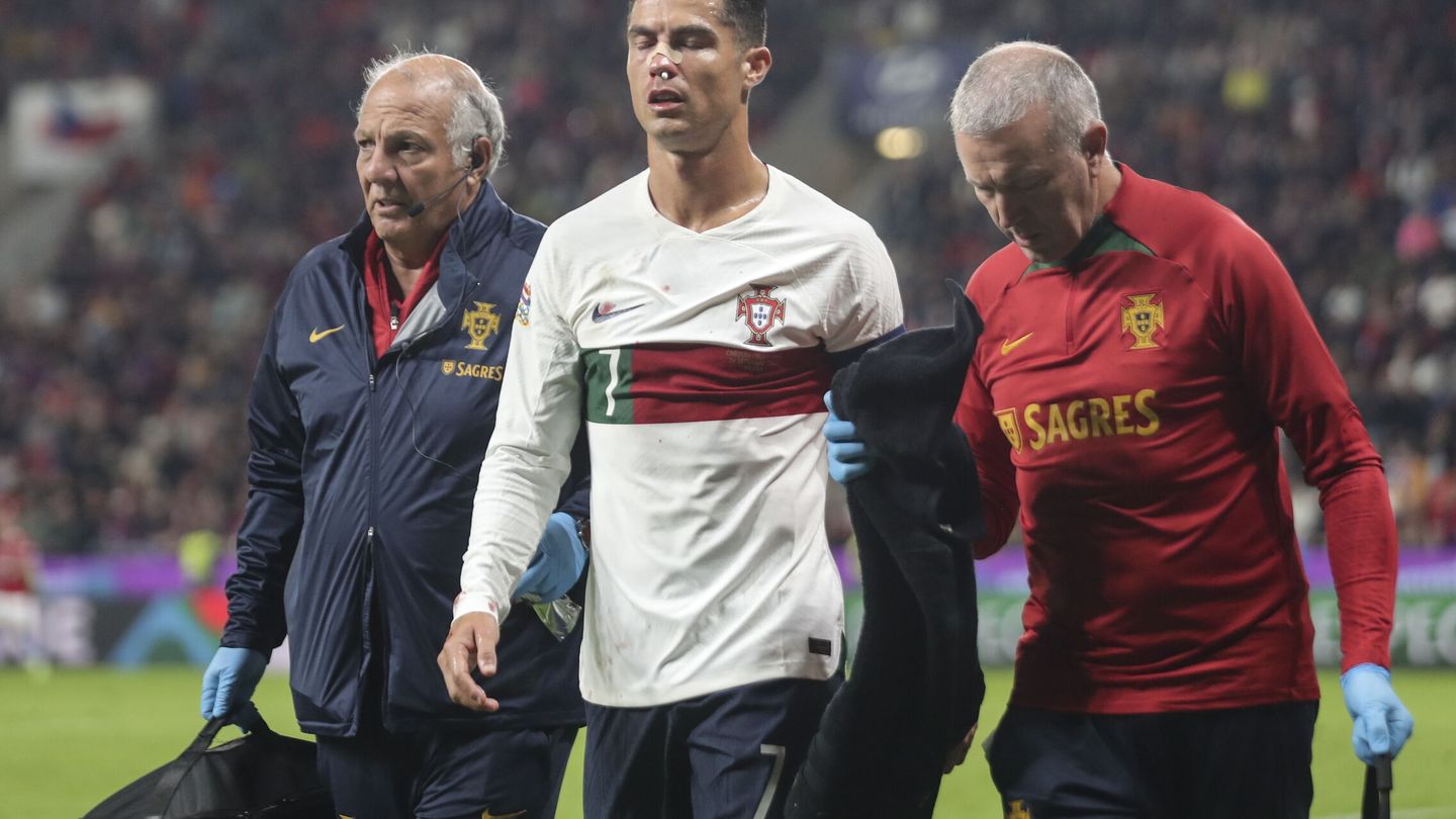 Cristiano Ronaldo es atendido tras sufrir un golpe en la nariz en Praga