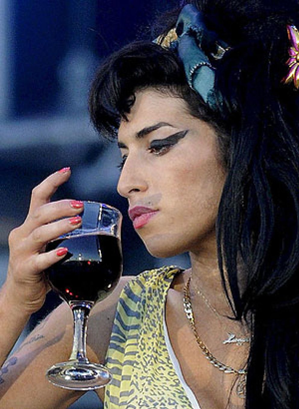 Foto: Las sobredosis de Amy Winehouse le han provocado daños cerebrales