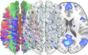 Así funciona nuetro cerebro, según la teoría de redes complejas