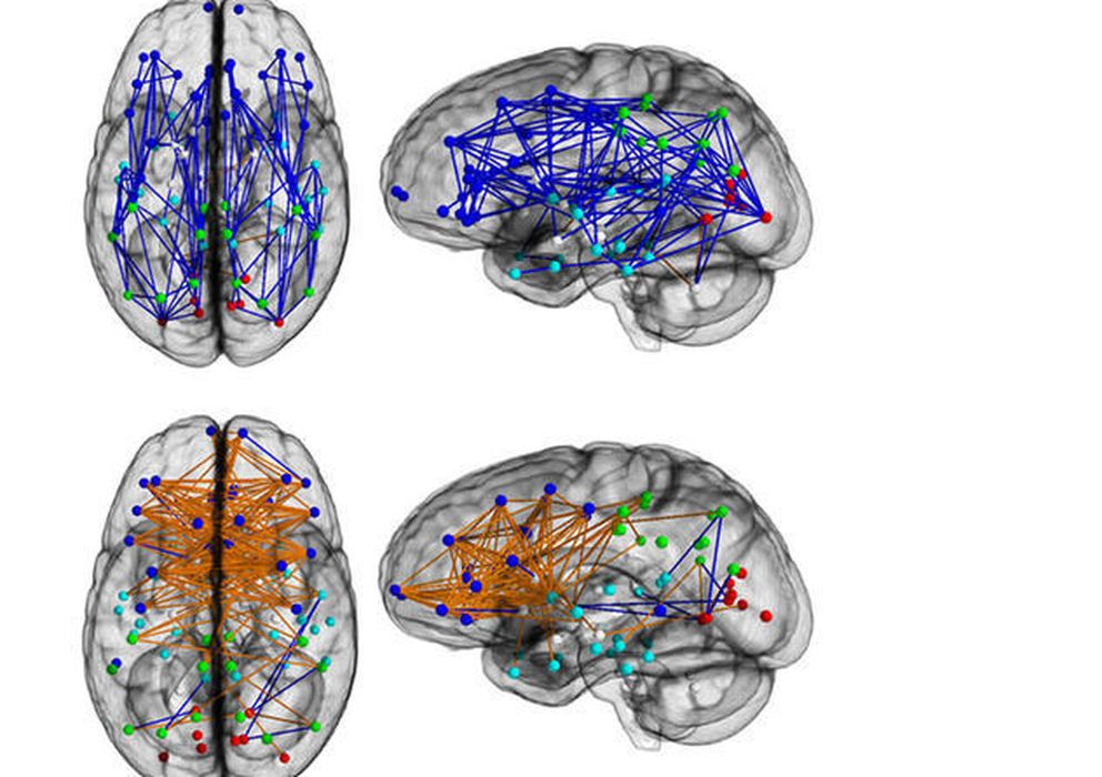 Foto: El cerebro masculino (en la imagen) está preparado para trabajar dentro de cada hemisferio, al contrario que el femenino. (PNAS)
