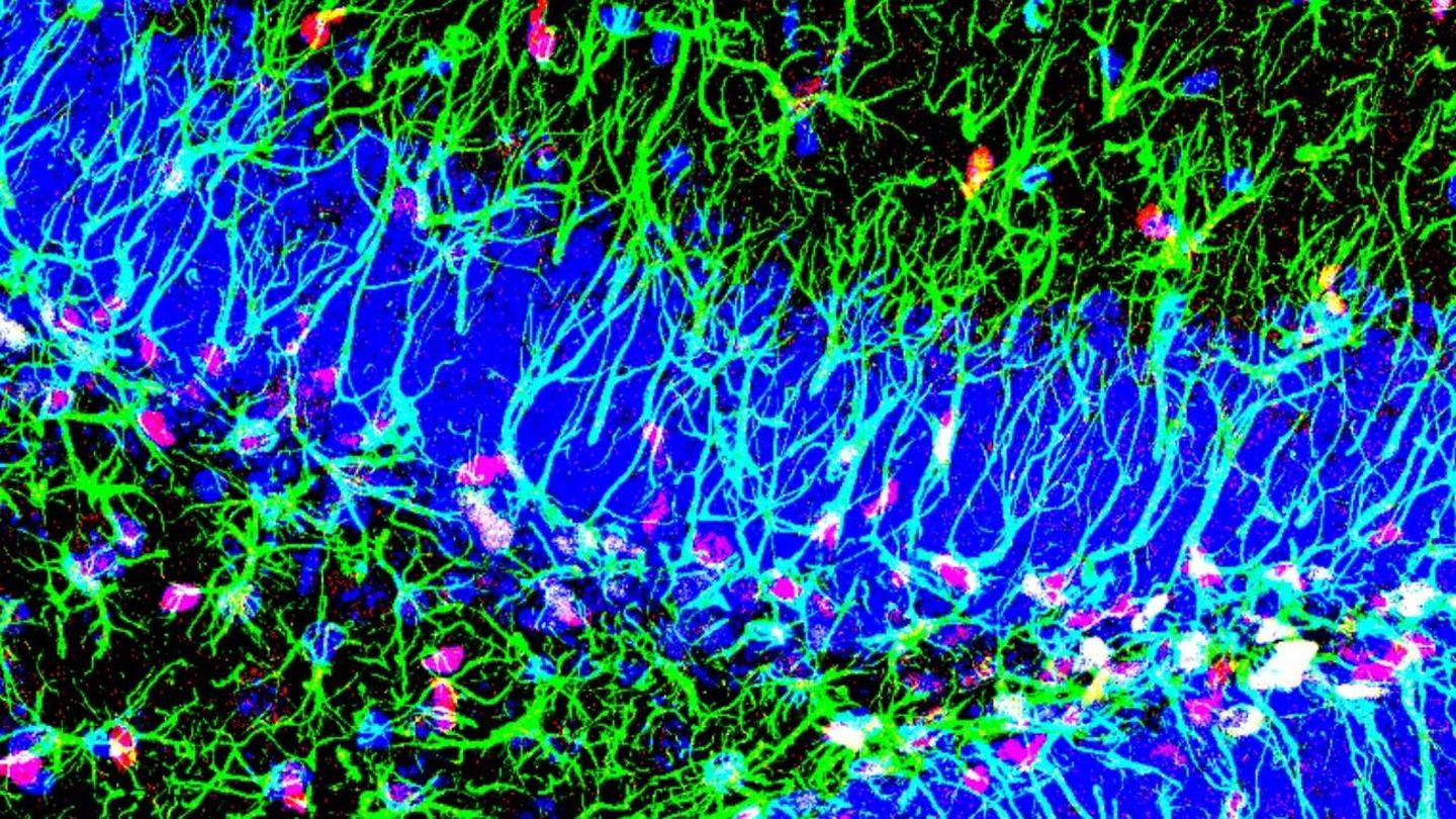 Foto: Hipocampo con presencia de células madre y la proteína Sox6 (Cristina Medina-Menéndez)
