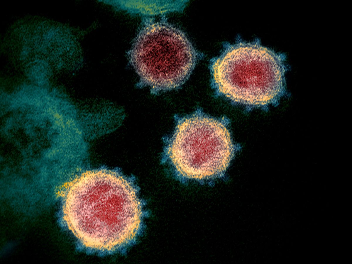 Foto: El coronavirus en microscopio. (Reuters)