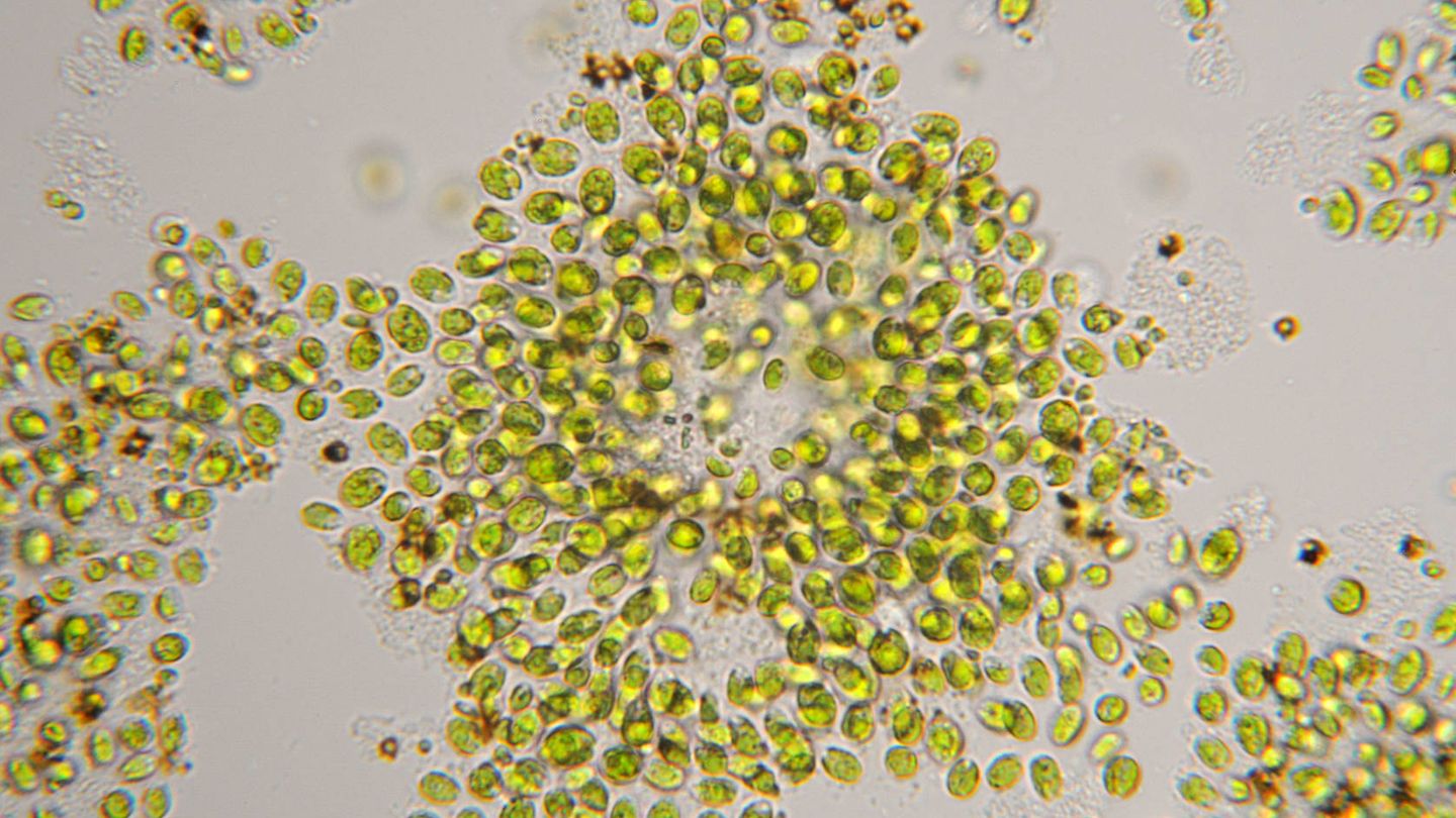 El alga, en el microscopio. (iStock)