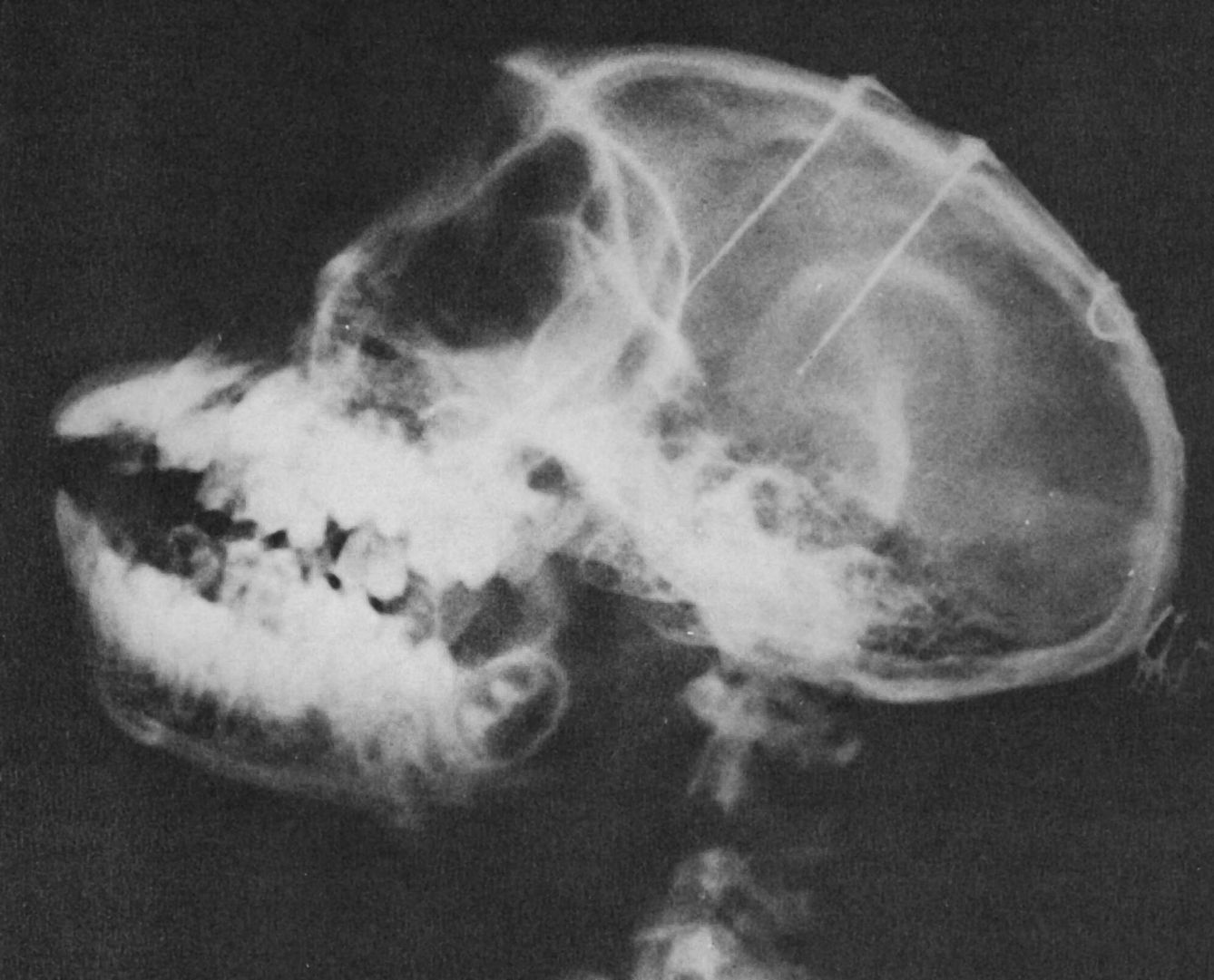 Radiografía de la cabeza de un mono que muestra dos conjuntos de electrodos implantados en los lóbulos frontales y en el tálamo del libro 'Physical Control of the Mind'
