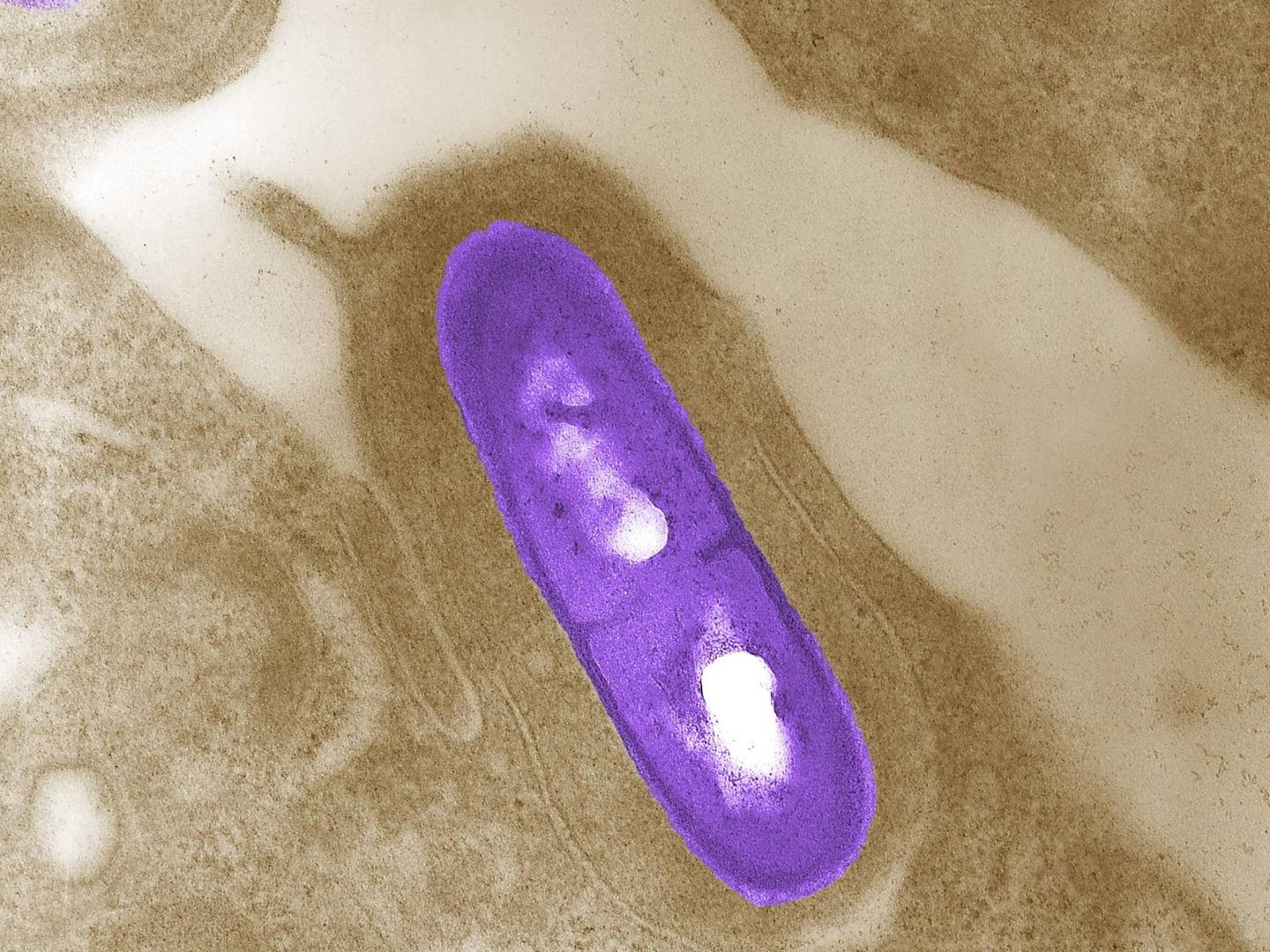 Imagen microscópica de una bacteria Listeria monocytogenes. (Reuters)